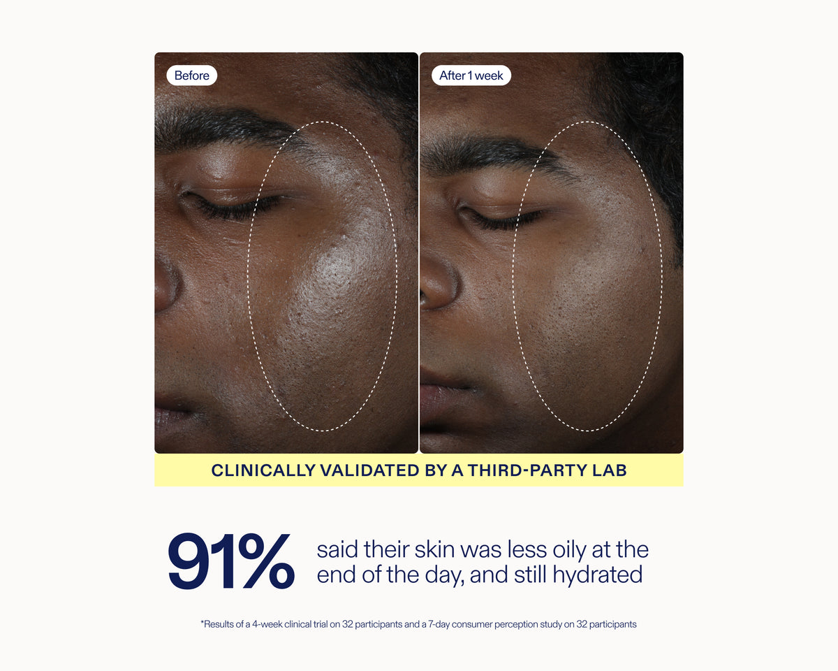 Before-and-after skin comparison showing a person's face with oily, shiny skin labeled 'Before' and smoother, less oily skin labeled 'After 1 week'. Text below states 'CLINICALLY VALIDATED BY A THIRD-PARTY LAB' and '91% said their skin was less oily at the end of the day, and still hydrated'.
