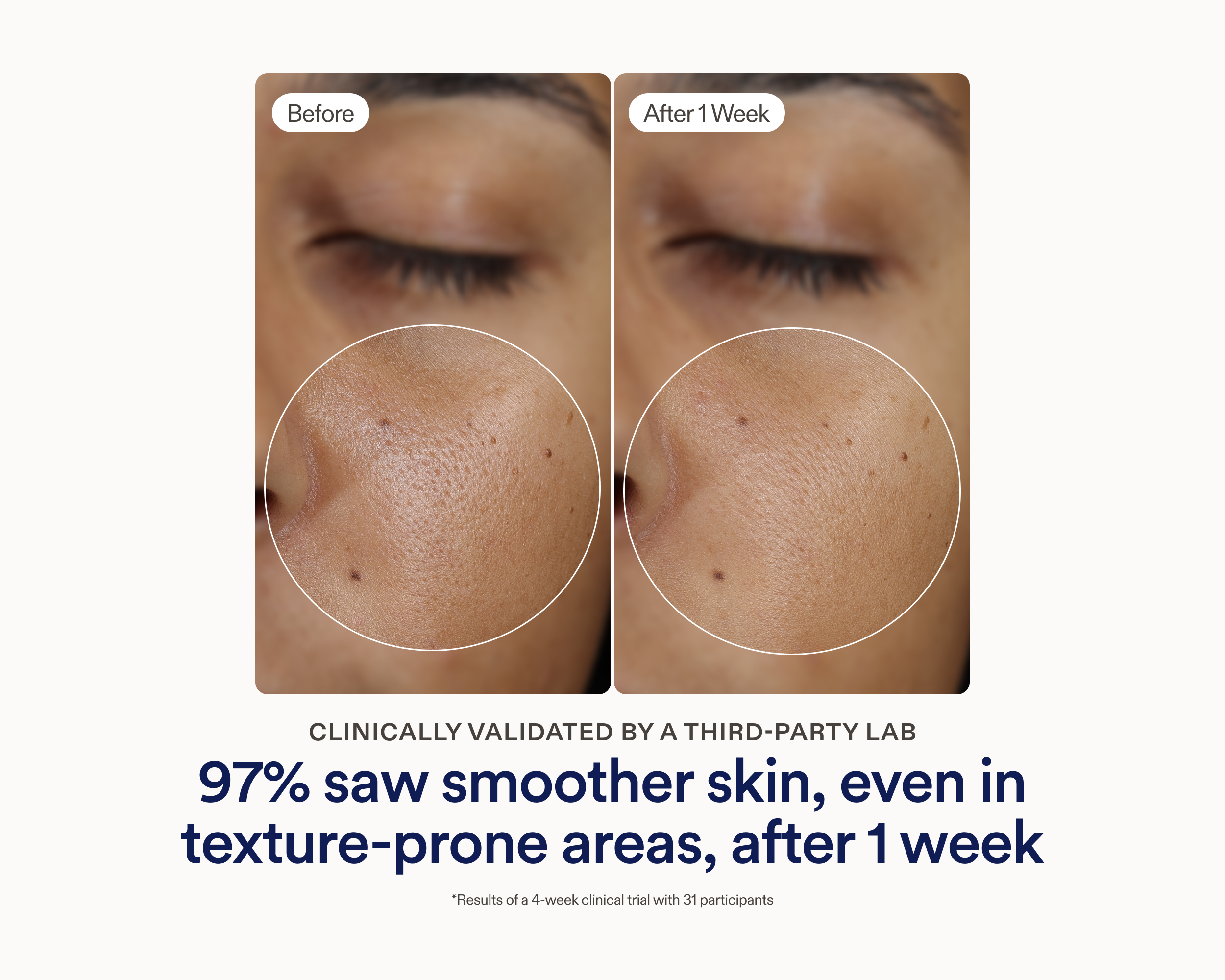 Side-by-side before and after clinical photos showing visibly smoother skin texture on the cheek after 1 week of using Skinfix Ceramide Prime Whipped Cream, with text reading: Clinically validated by a third-party lab — 97% saw smoother skin, even in texture-prone areas, after 1 week.