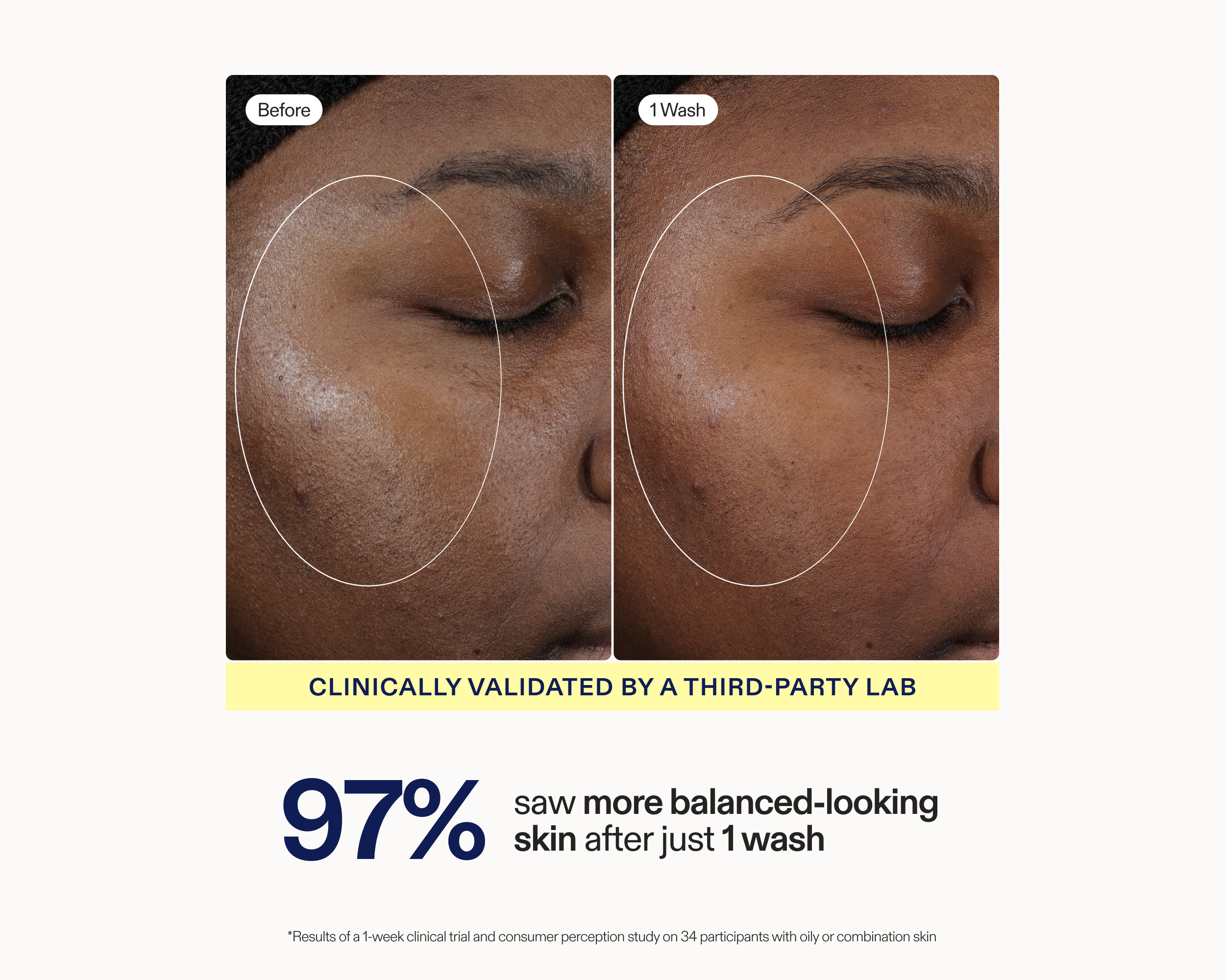 Side-by-side before and after clinical photos showing visibly more balanced-looking skin on the cheek after 1 wash with Skinfix Balancing Soft-Foam Clay Cleanser, with text reading: Clinically validated by a third-party lab — 97% saw more balanced-looking skin after just 1 wash.