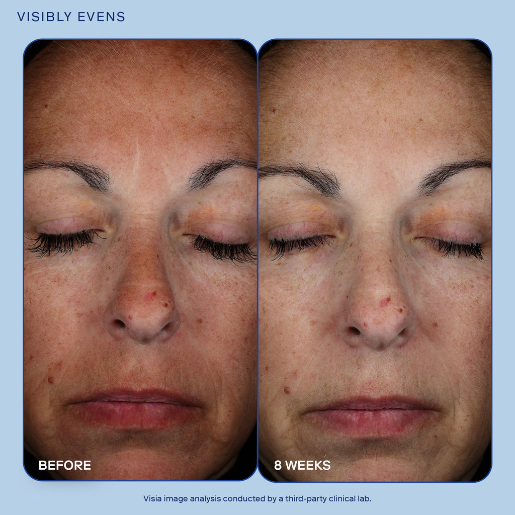 Image showing before and after results of Skinfix Exo + Ectoin Intensive Repair Baume for 8 weeks. Before results show woman with redness, wrinkles, fine lines. The after results show more even skin, less fine lines and wrinkles and overall brighter skin.