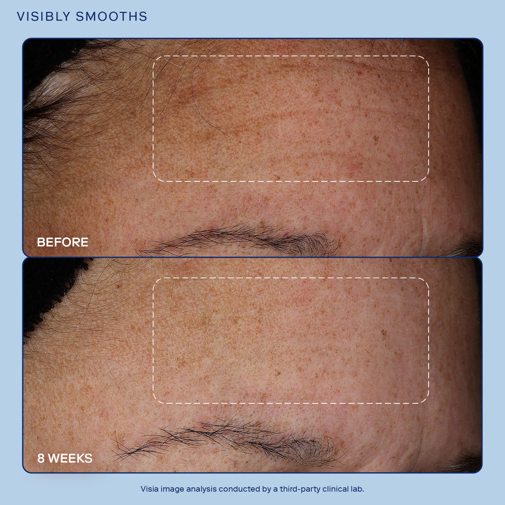 Image showing before and after results of Skinfix Exo + Ectoin Intensive Repair Baume for 8 weeks. Image is zoomed in on forehead. In before results there are visible wrinkles on the forehead. In after results, there is visible improvement in wrinkles on the forehead.