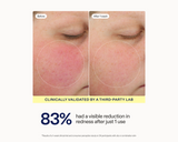 Before-and-after skin redness comparison on a person's cheek, labeled 'Before' and 'After 1 wash,' with text stating 'Clinically validated by a third-party lab' and '83% had a visible reduction in redness after just 1 use.'.