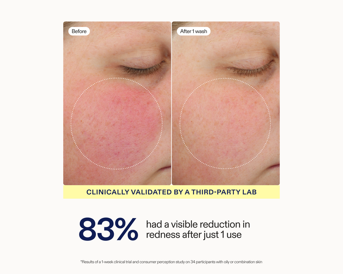 Before-and-after skin redness comparison on a person's cheek, labeled 'Before' and 'After 1 wash,' with text stating 'Clinically validated by a third-party lab' and '83% had a visible reduction in redness after just 1 use.'.