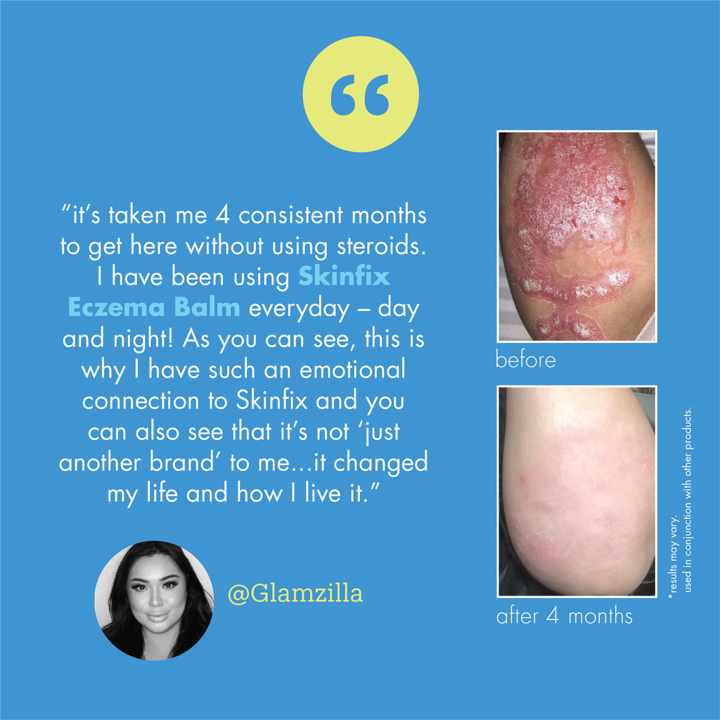 Eczema+ Targeted Body Balm testimonial