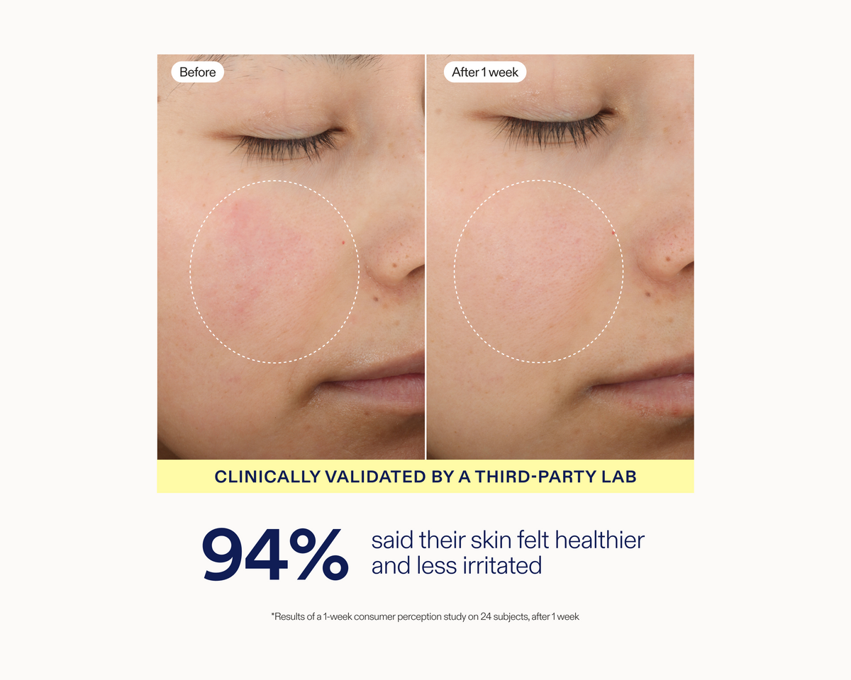 Before-and-after skin comparison showing a person's cheek with redness reduced after one week, plus text stating 'Clinically validated by a third-party lab' and '94% said their skin felt healthier and less irritated'.