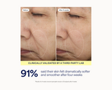 Before-and-after skin comparison of a person's nose and cheek area, showing visible texture improvement after four weeks. Text below reads 'CLINICALLY VALIDATED BY A THIRD-PARTY LAB' and '91% said their skin felt dramatically softer and smoother after four weeks.