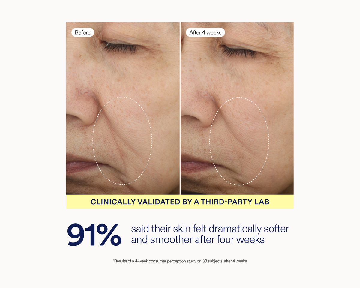 Before-and-after skin comparison of a person's nose and cheek area, showing visible texture improvement after four weeks. Text below reads 'CLINICALLY VALIDATED BY A THIRD-PARTY LAB' and '91% said their skin felt dramatically softer and smoother after four weeks.