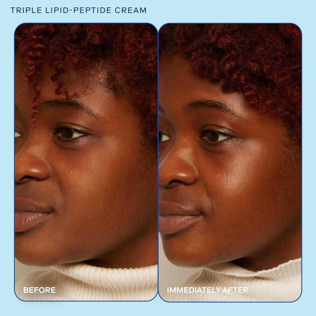 Triple Lipid-Peptide Cream before and after image