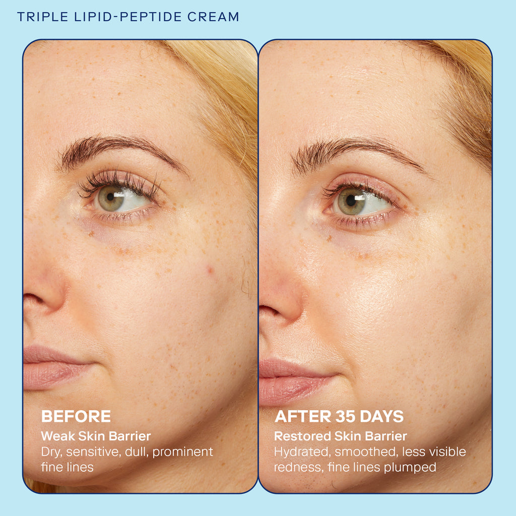 Triple Lipid-Peptide Cream before and after image