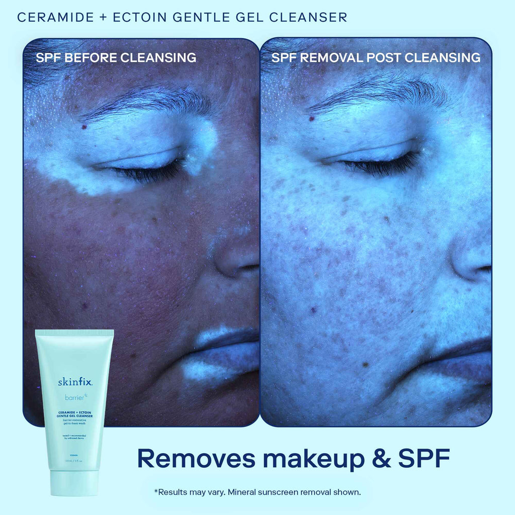 Ceramide + Ectoin Gentle Gel Cleanser before and after image