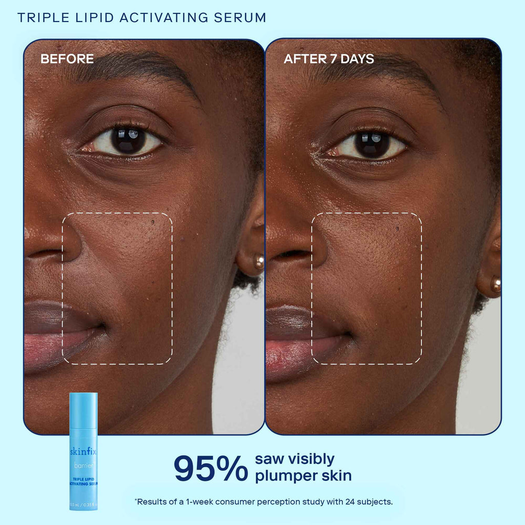 Triple Lipid Activating Serum before and after image