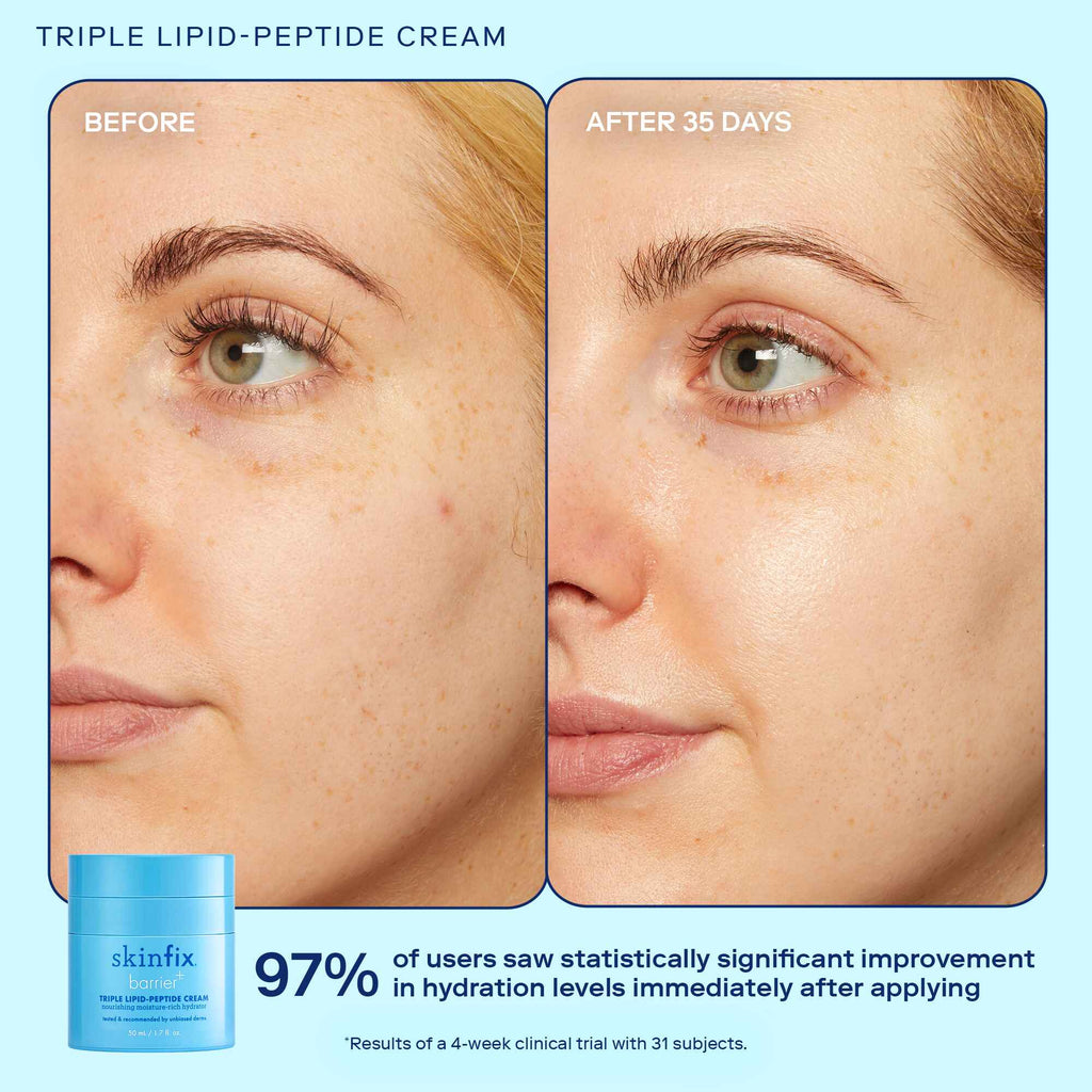 Triple Lipid-Peptide Cream before and after image
