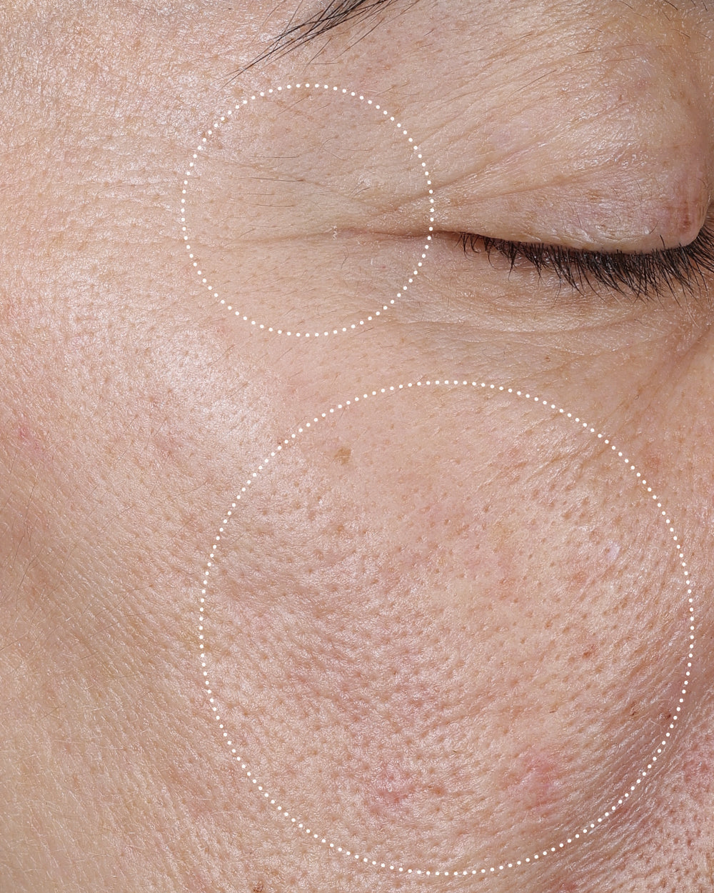 Close-up of a person's face with improved texture and firmer skin