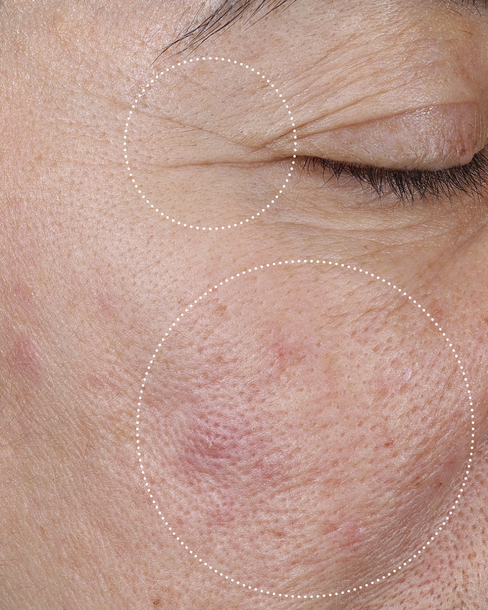 Close-up of a person's face with wrinkles and skin texture highlighted.