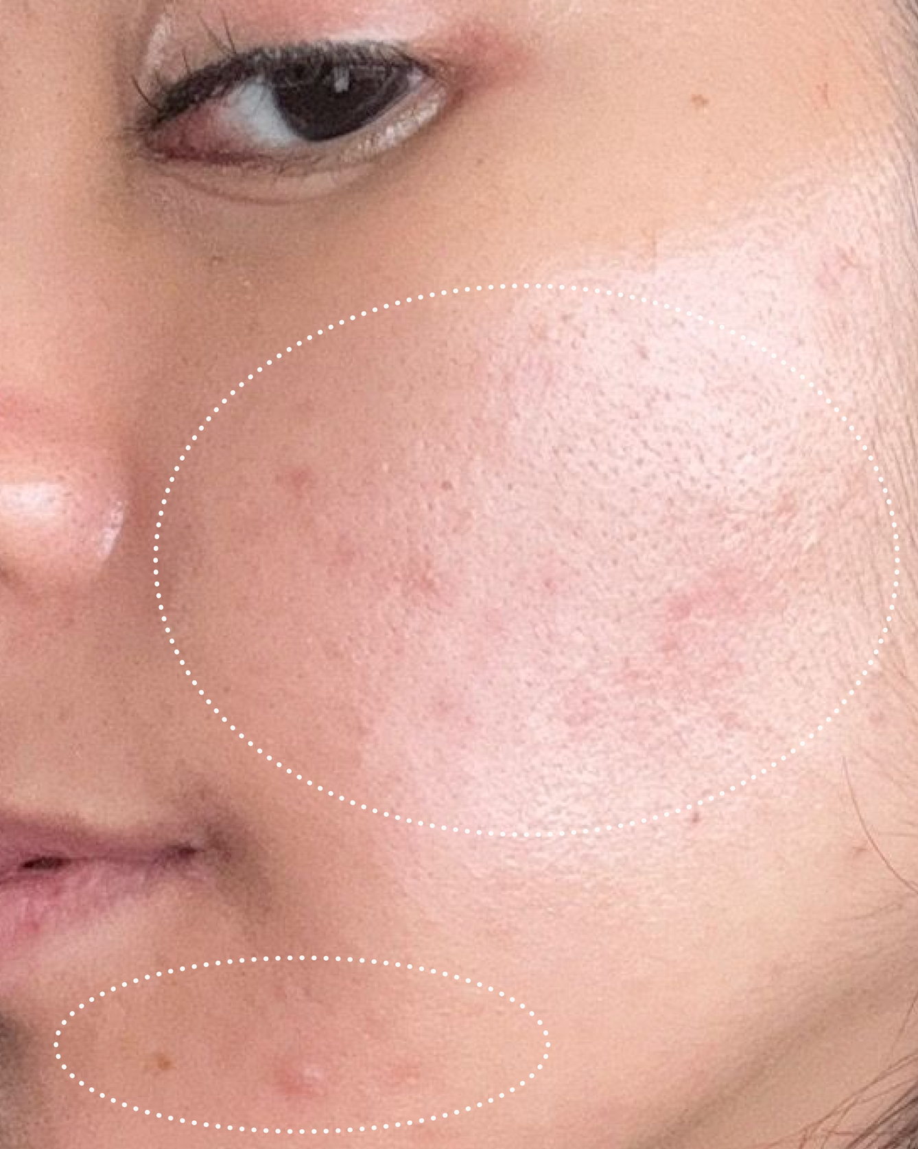 Close-up of a person's face with visibly less blemishes on the skin and brighter skin.