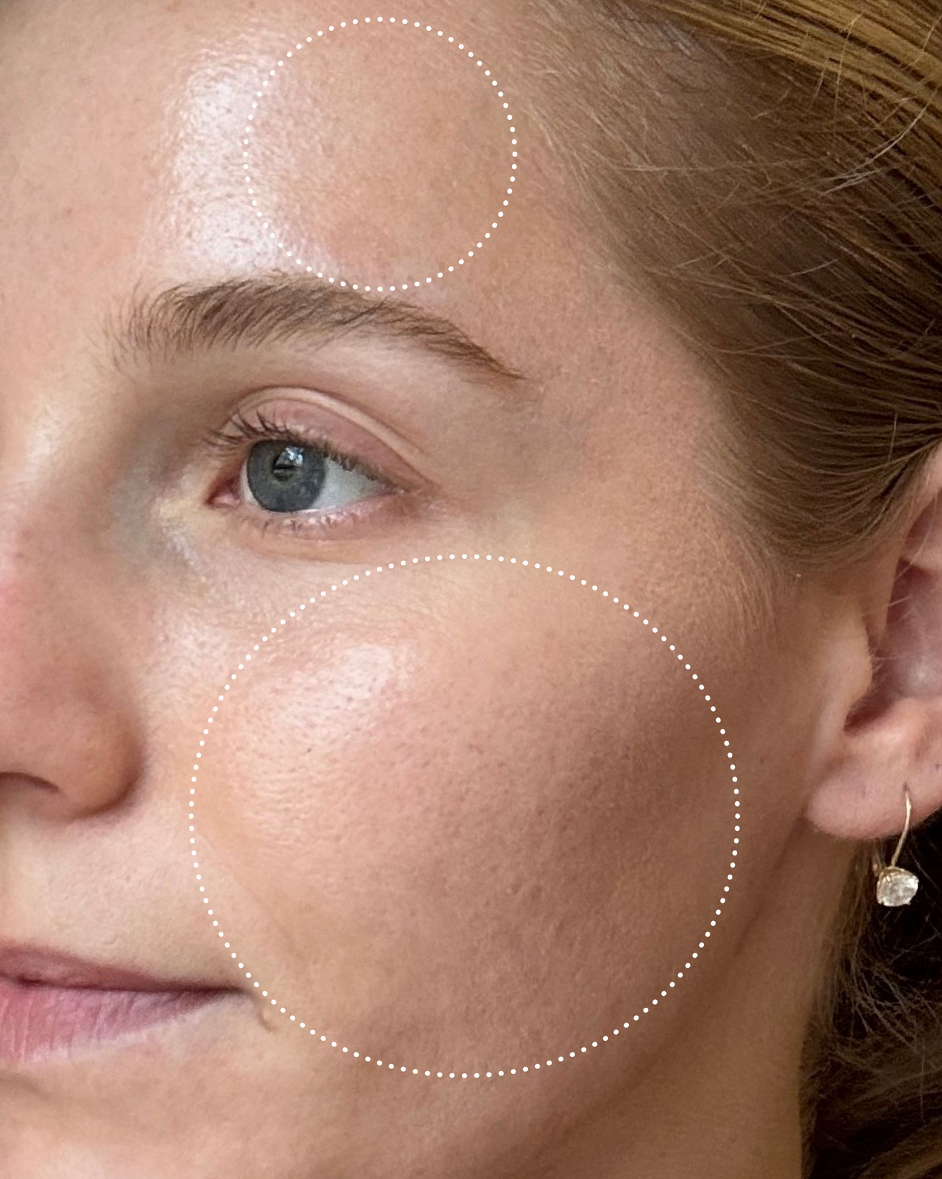 Close-up of a person's face with visibly less texture and brighter skin