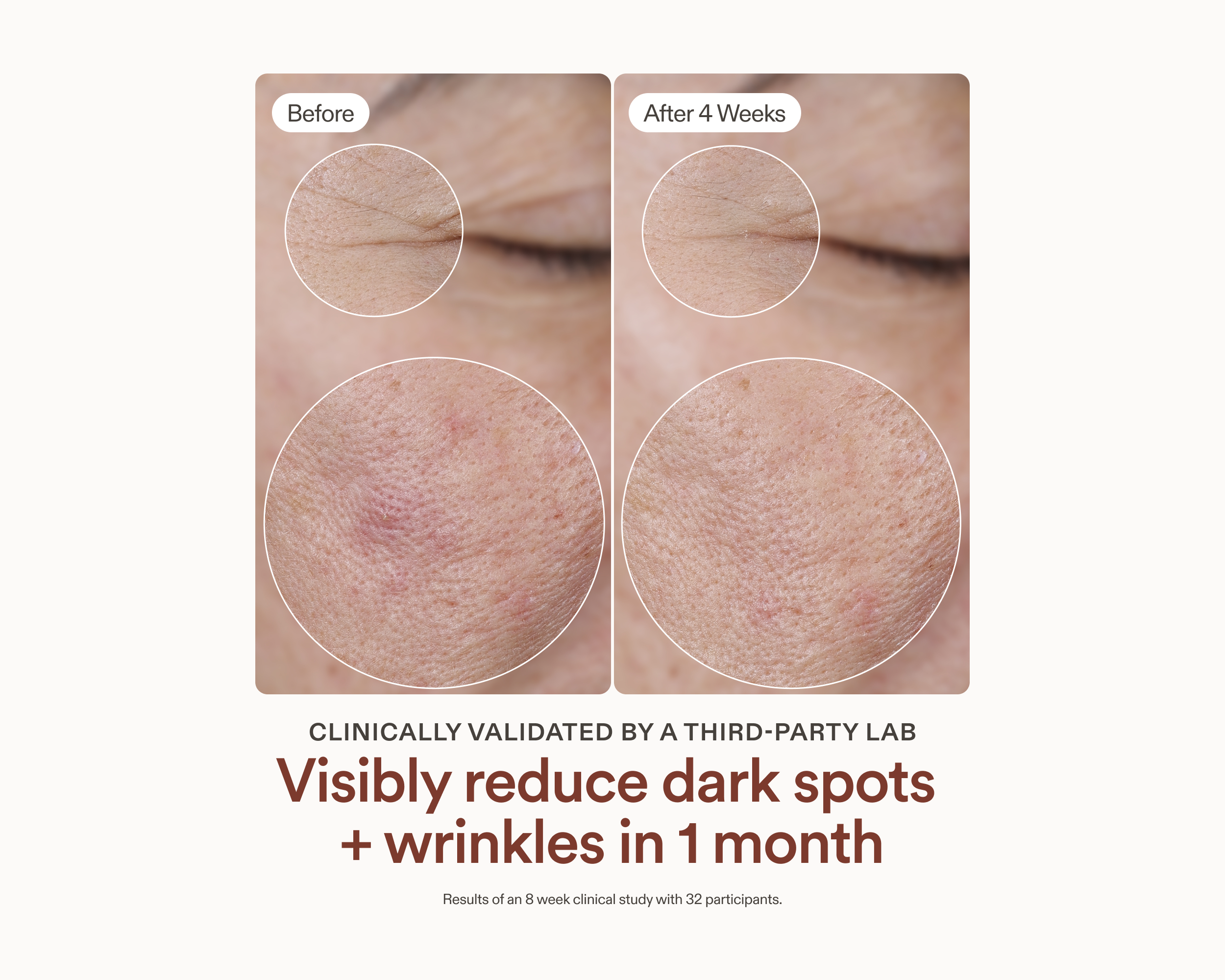 Before and after comparison of dark spots and wrinkles on skin with text about clinical validation.
