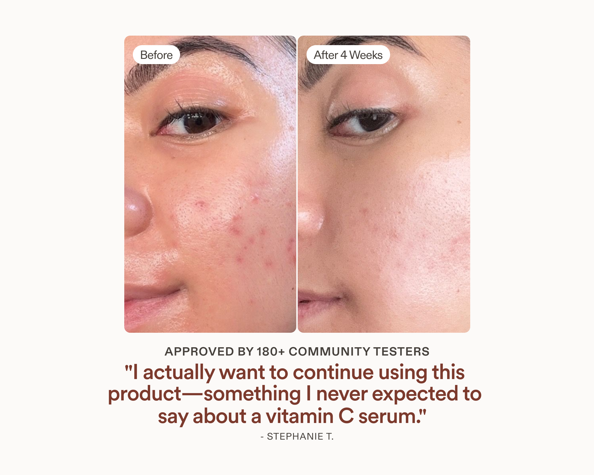 Before and after comparison of a face with blemishes, showing improvement over 4 weeks after using vitamin c serum.