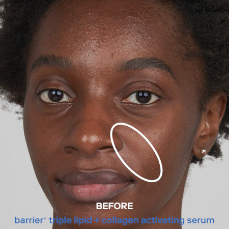 before and after of Barrier+ Triple Lipid + Collagen Activating Serum