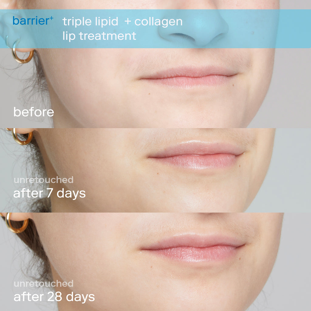 triple lipid + collagen lip treatment before and after