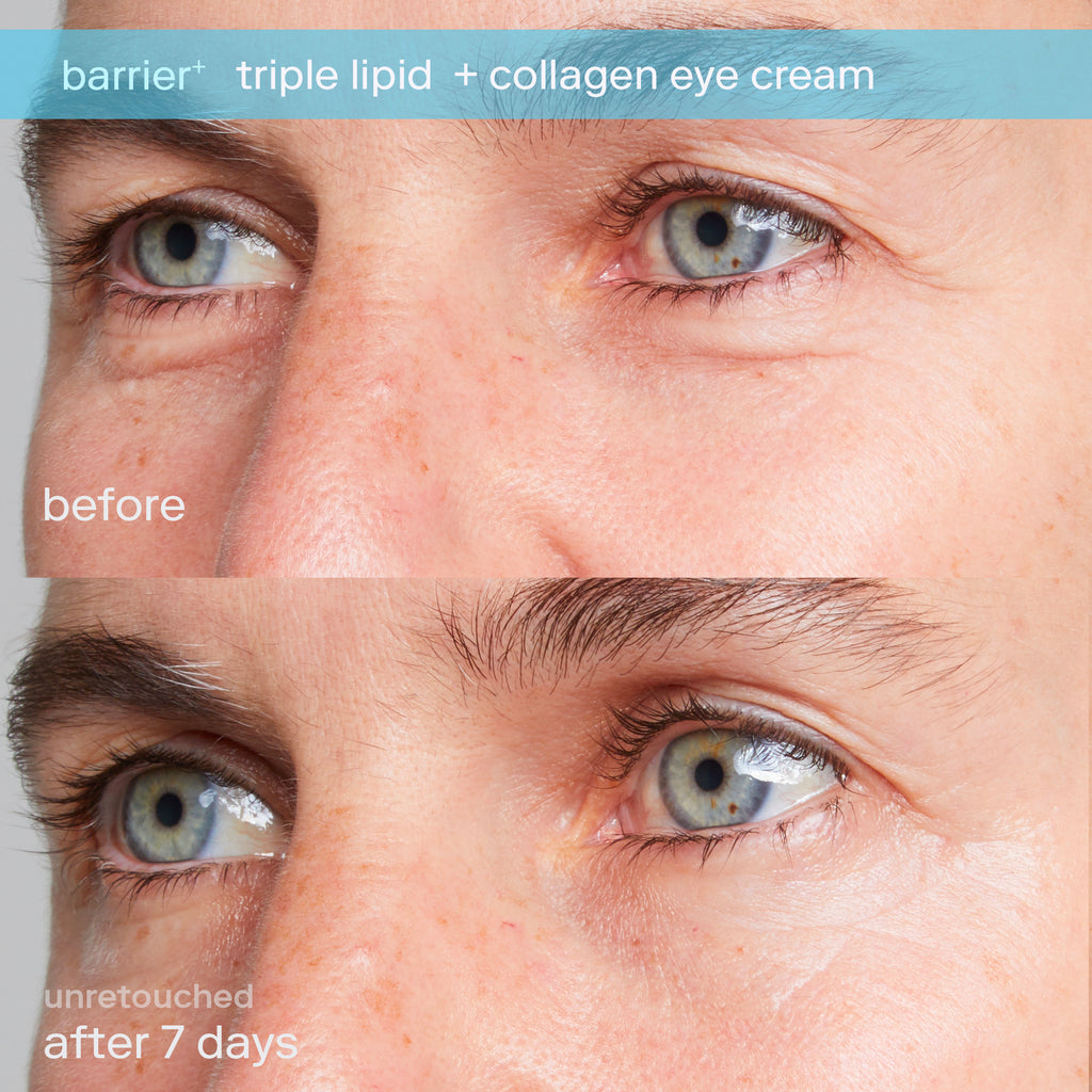 Triple Lipid + Collagen Eye Treatment Active Before and After 7 Days