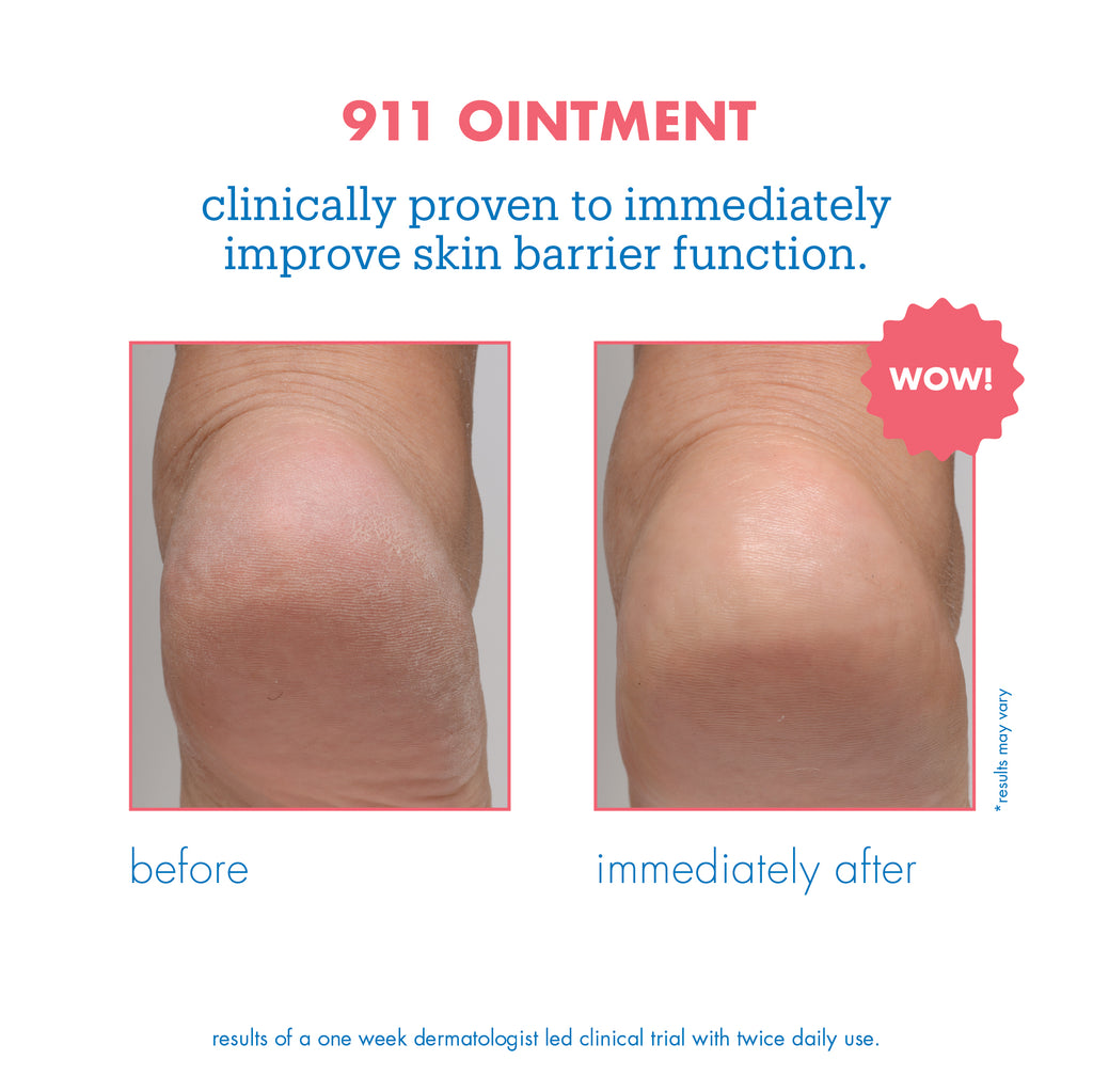 Remedy+ 911 Ointment before & after